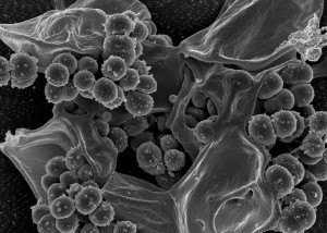 Resistant bacteria  – a germaphobe’s greatest nightmare. Creative Commons